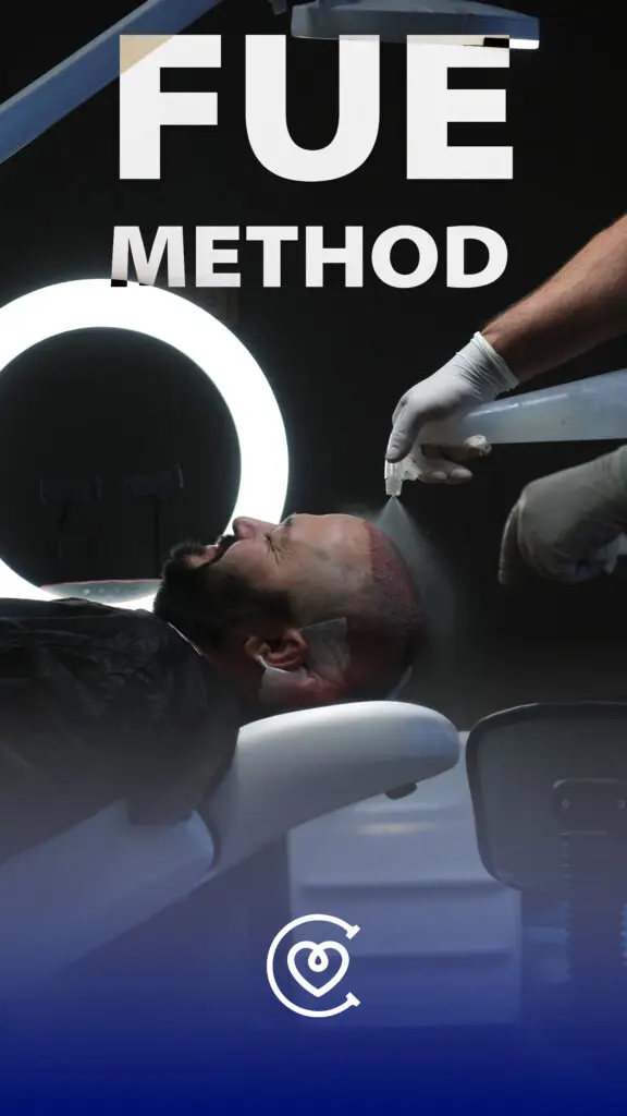 пересадки волос методом FUE