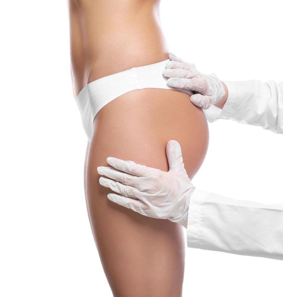 Восстановление после увеличения ягодиц имплантами в Cayra Clinic Турция