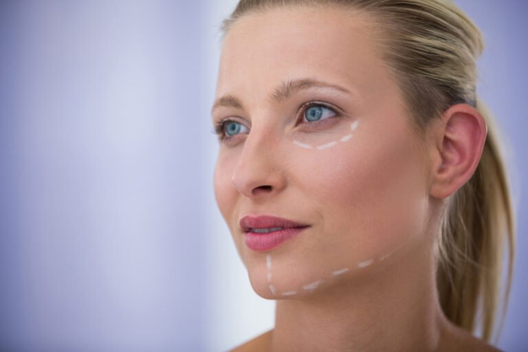 Операция по подтяжке лица в Cayra Clinic