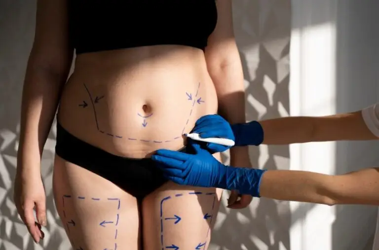 Операция по увеличению ягодиц в Турции