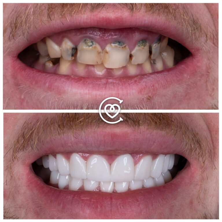 Отзывы о Стоматологических Услугах