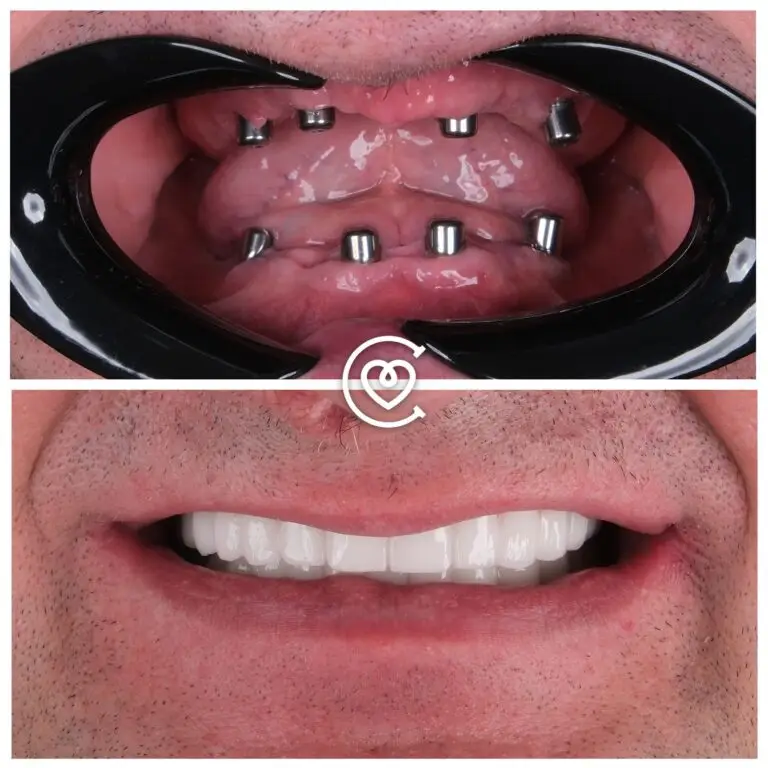 Отзывы о Стоматологических Услугах