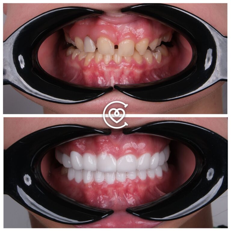 Отзывы о Стоматологическом Лечении