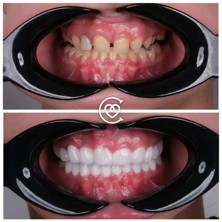 Отзывы о Стоматологическом Лечении