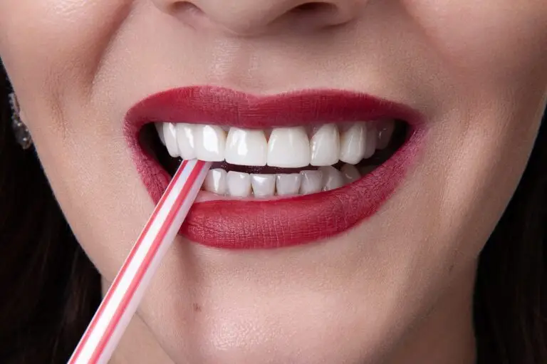 Виниры из Турции