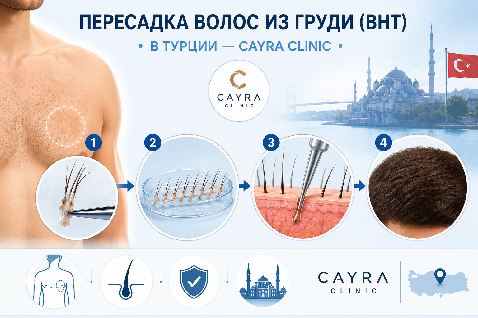 Пересадка волос из груди (BHT) в Турции — Cayra Clinic