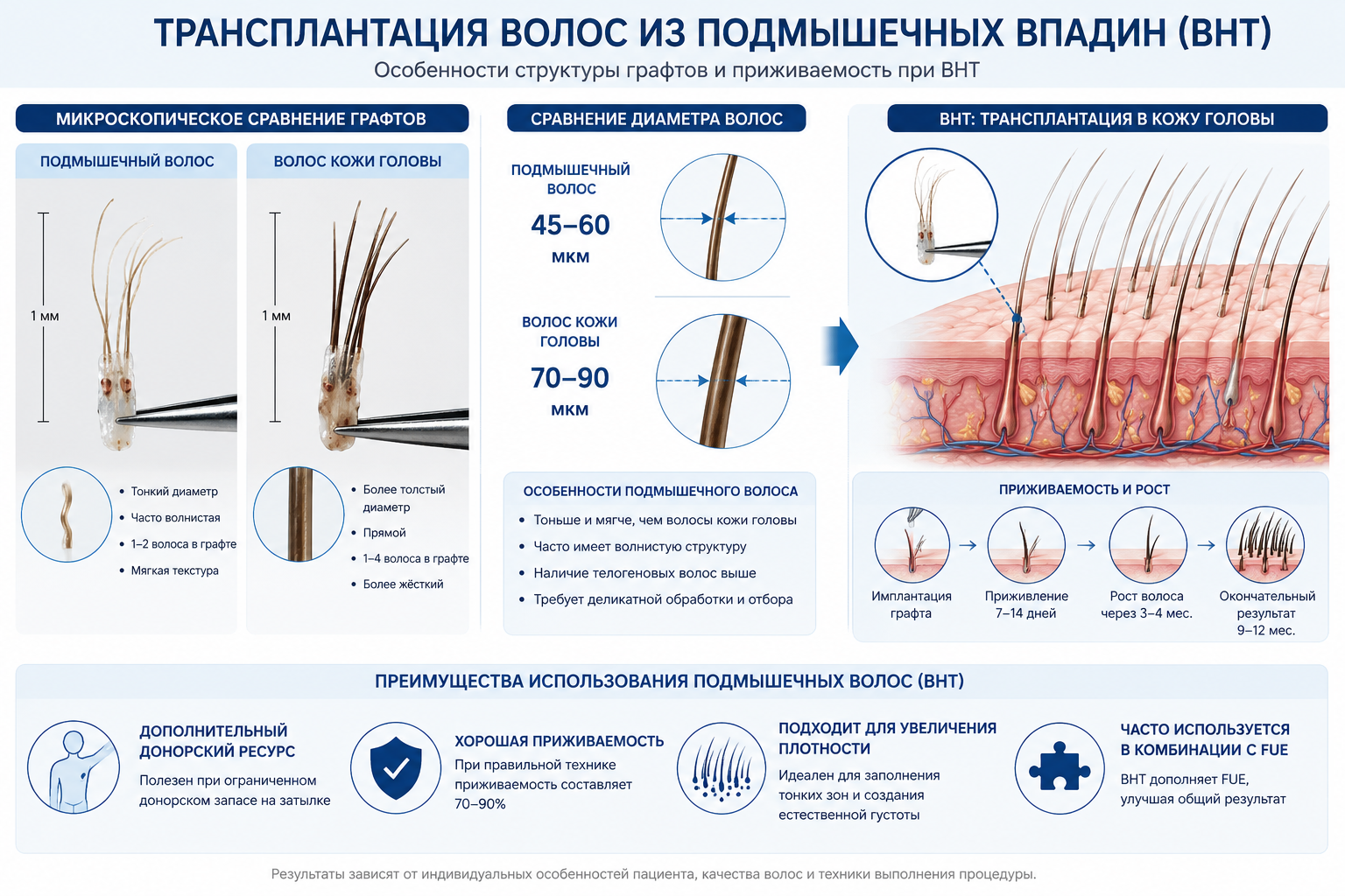 Пересадка волос из подмышек: BHT метод в Турции 2026