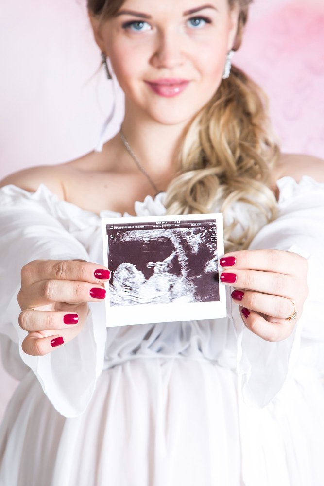 Перенос эмбриона при ЭКО в клинике Cayra Clinic Турция