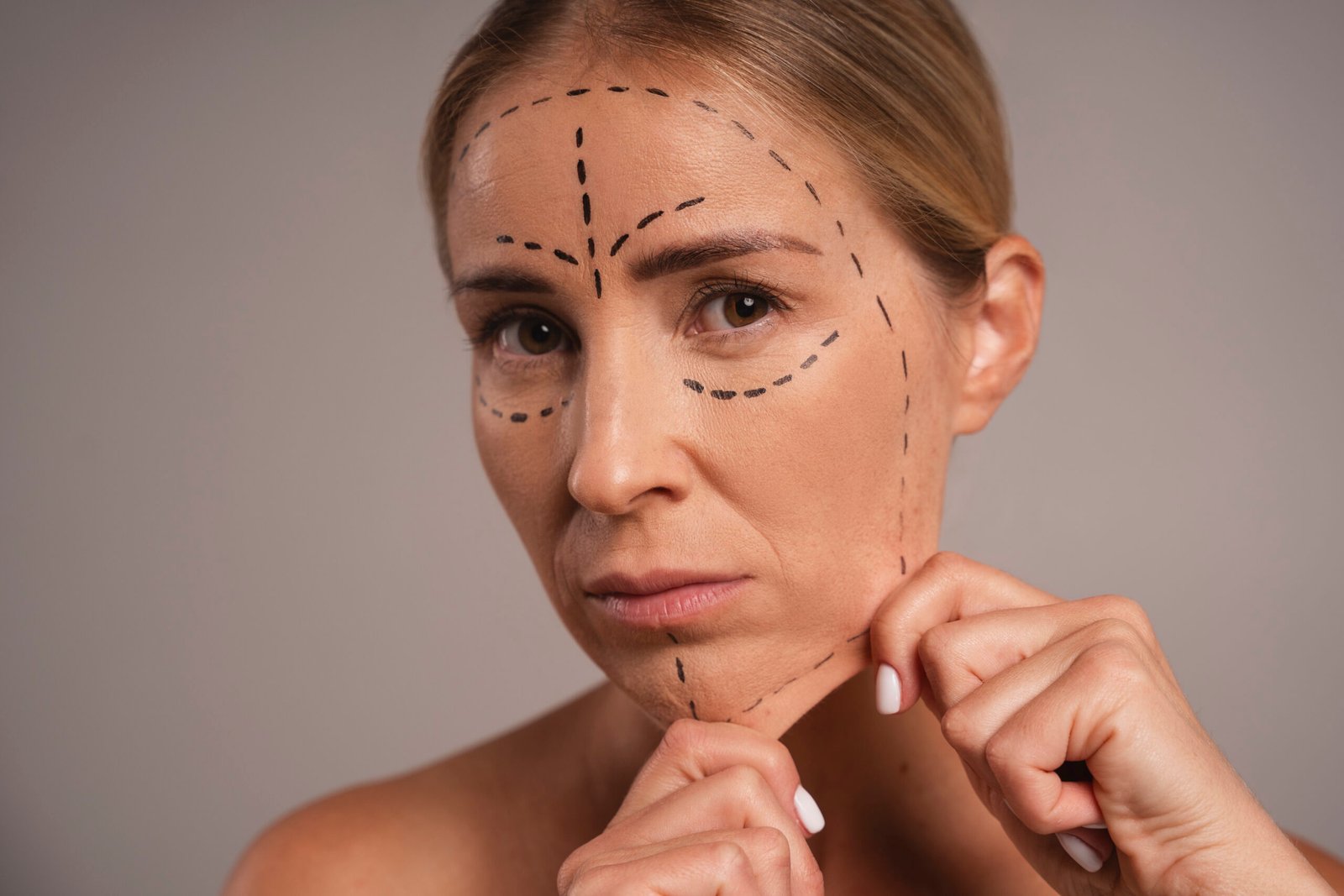 Омоложение средней зоны лица и скул эндоскопическим методом в Cayra Clinic