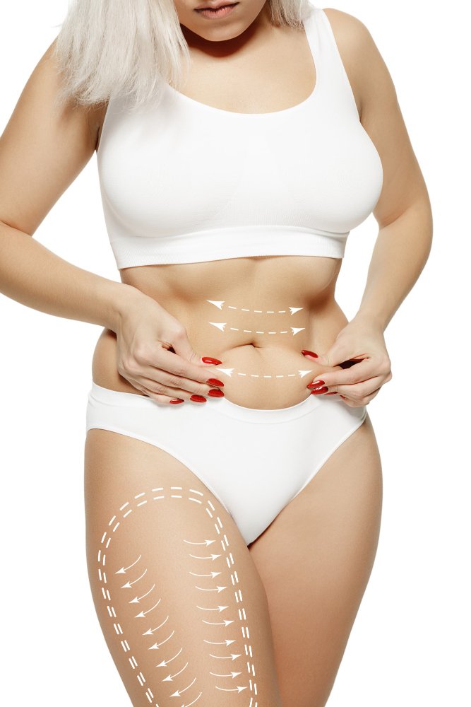 Хирург Cayra Clinic проводит лазерную липосакцию SmartLipo в Анталье