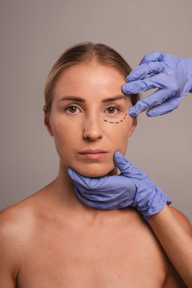 Кантопластика в Турции — коррекция формы глаз в клинике Cayra Clinic Анталья