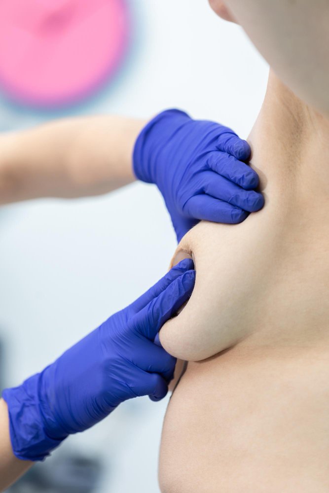 Техники мастопексии и расположение рубцов в клинике Cayra Clinic