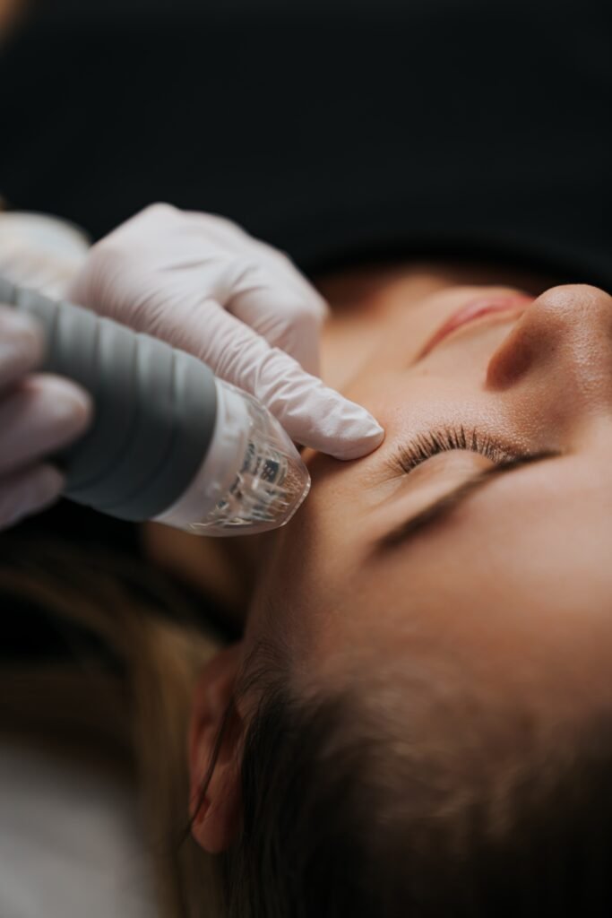 Процедура мезотерапии лица витаминными коктейлями в Турции — Cayra Clinic