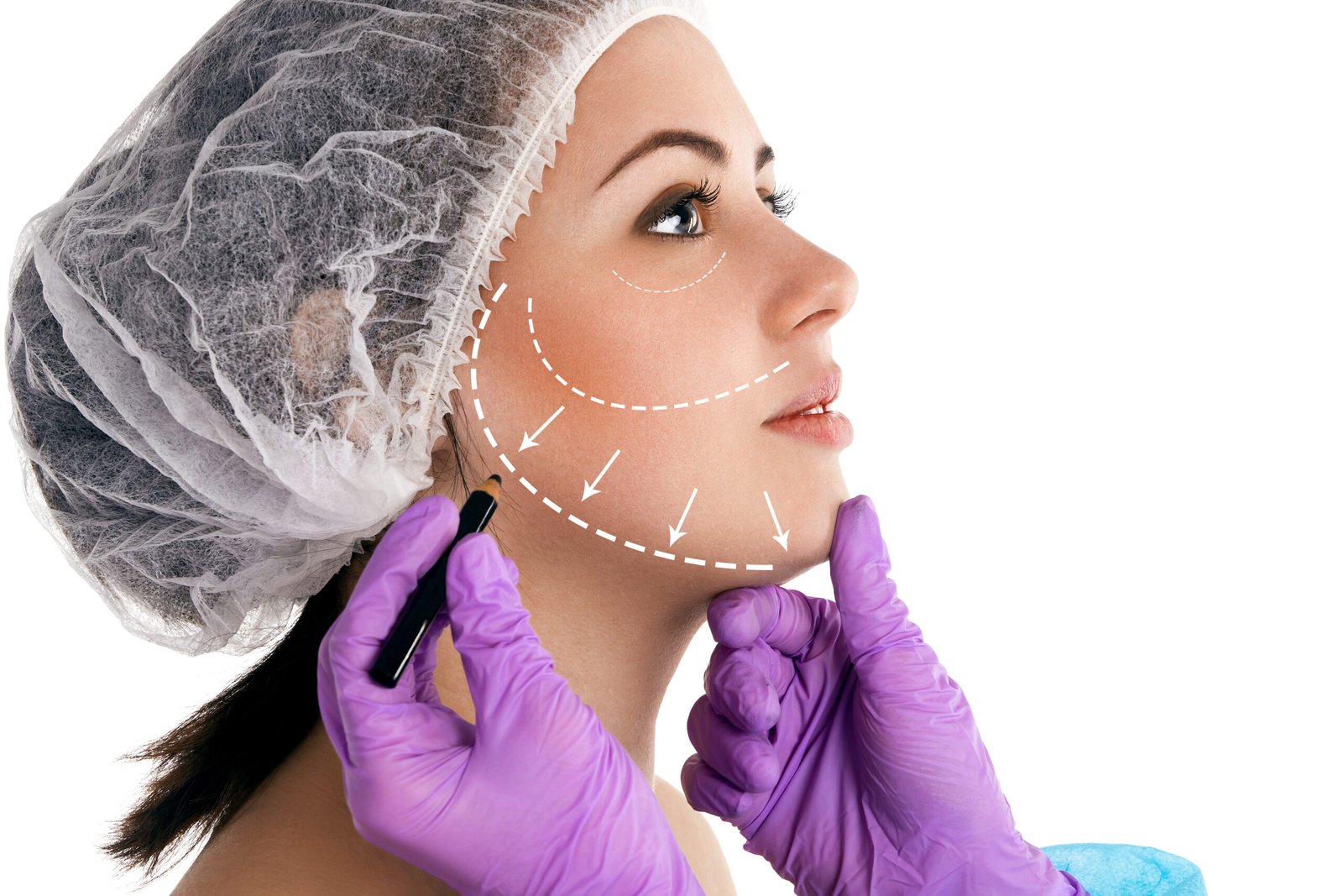 Мини-подтяжка лица нижней трети в Турции — клиника Cayra Clinic