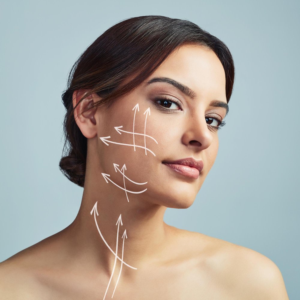 Нитевой лифтинг стимуляция коллагена в клинике Cayra Clinic Анталья