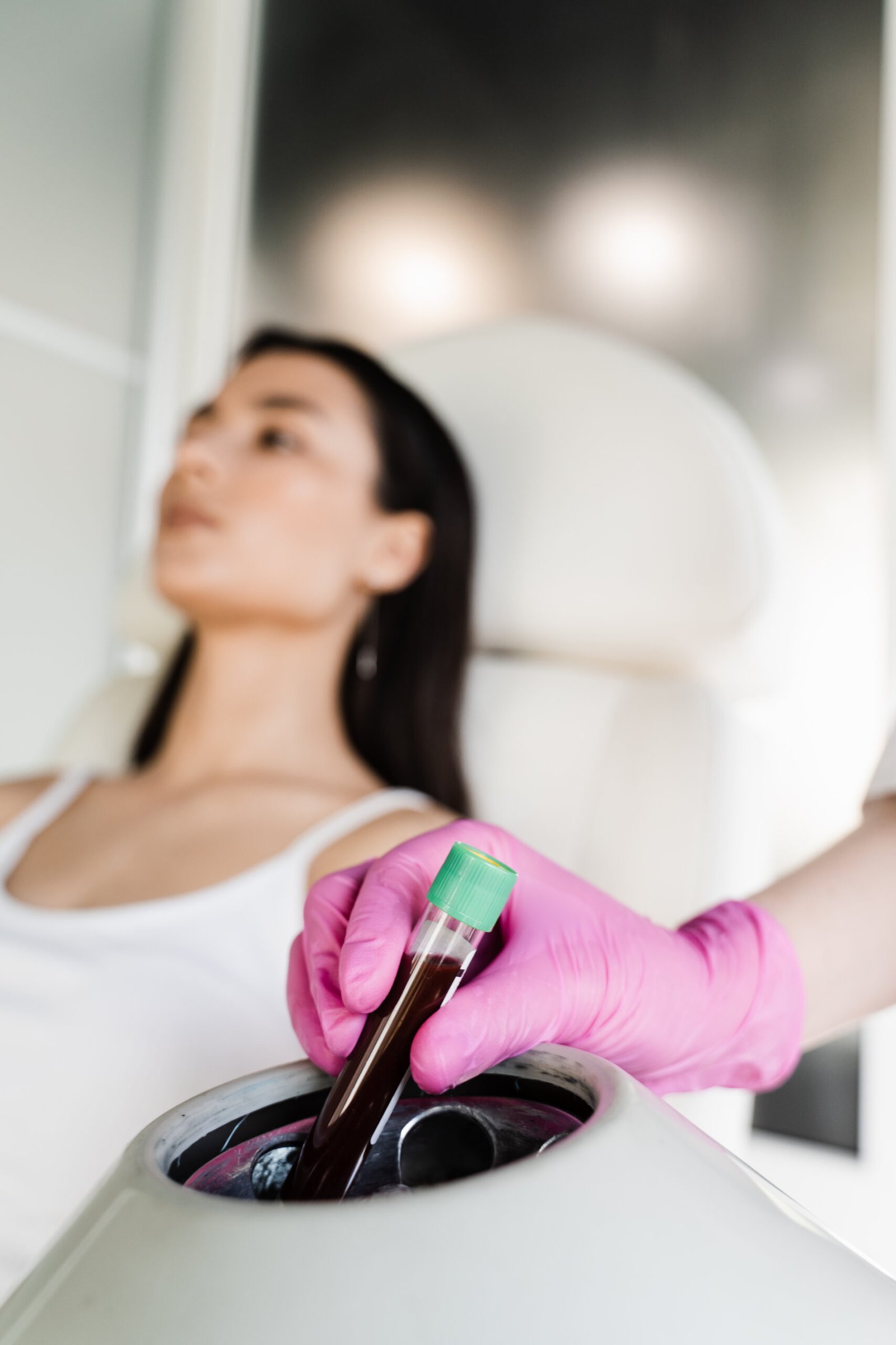 Результат омоложения лица методом PRP-терапии до и после в Cayra Clinic Анталья