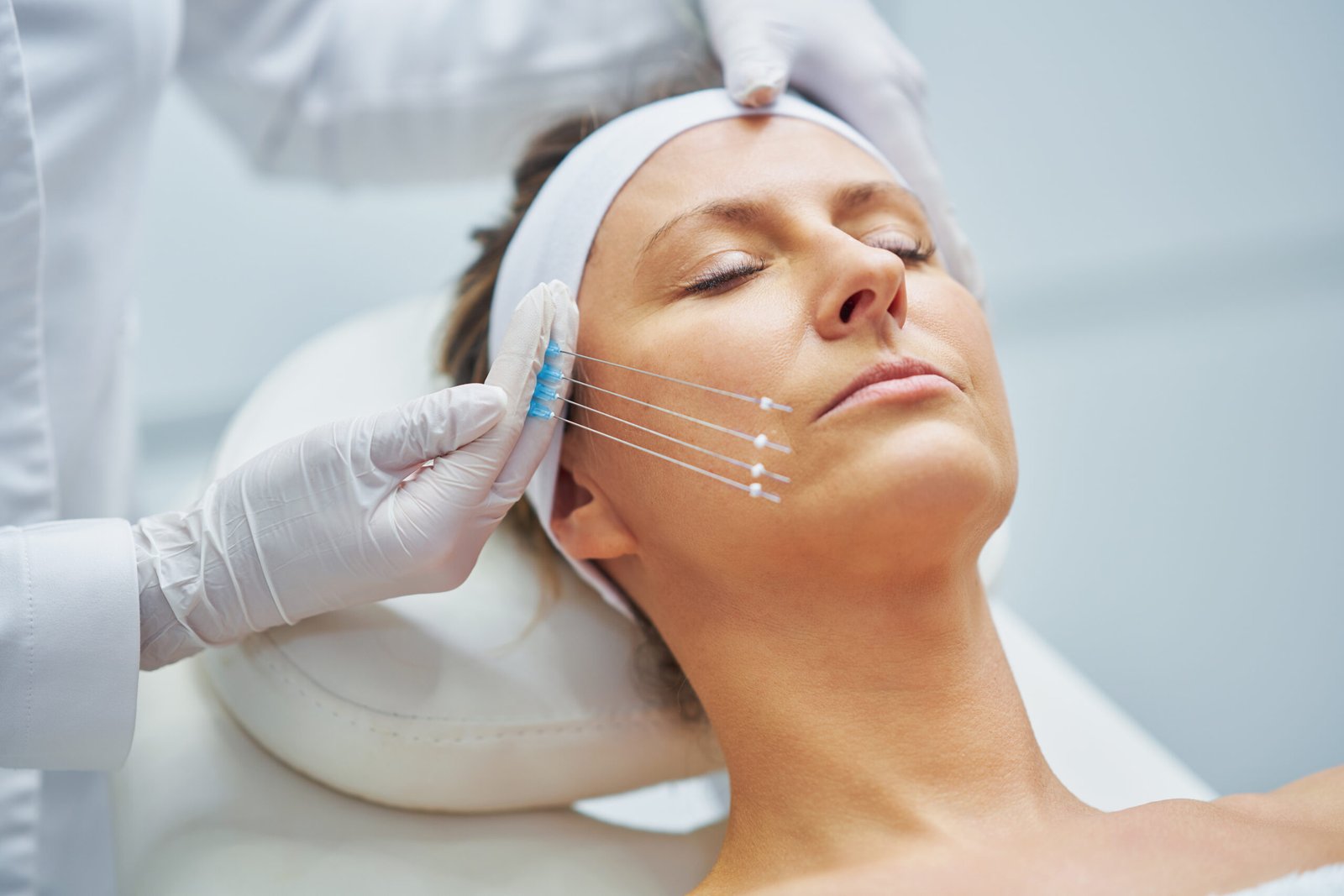 Процедура безоперационной подтяжки овала лица нитями в Cayra Clinic Стамбул
