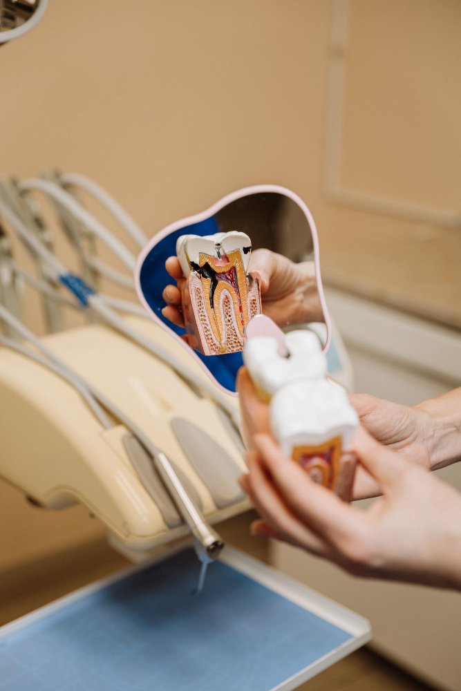 Удаление ретинированного зуба мудрости в клинике Cayra Clinic Турция