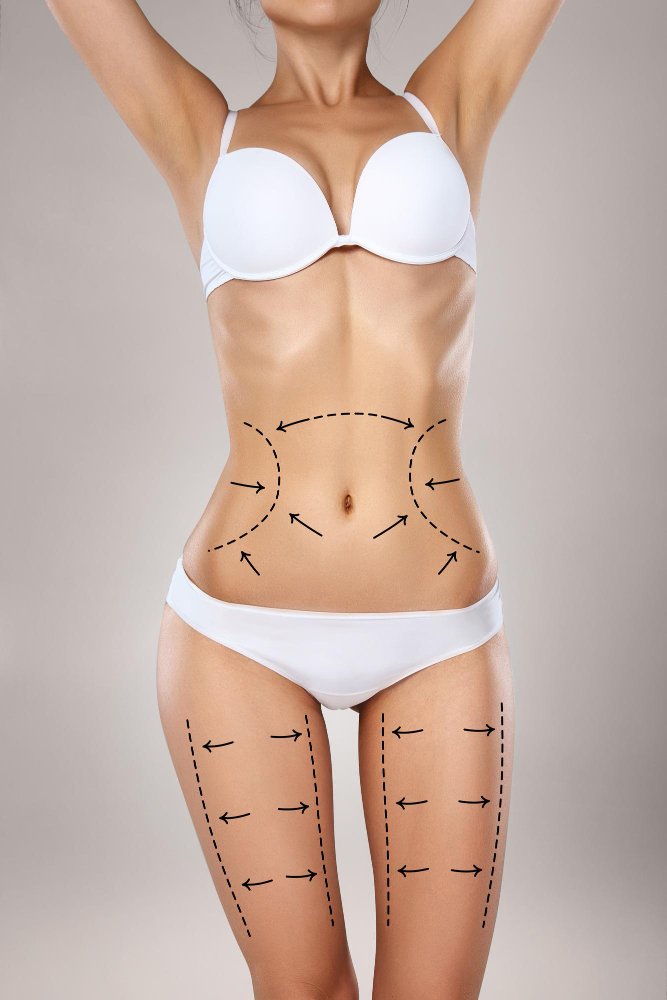 Тумесцентная липосакция в клинике Cayra Clinic Анталья Турция